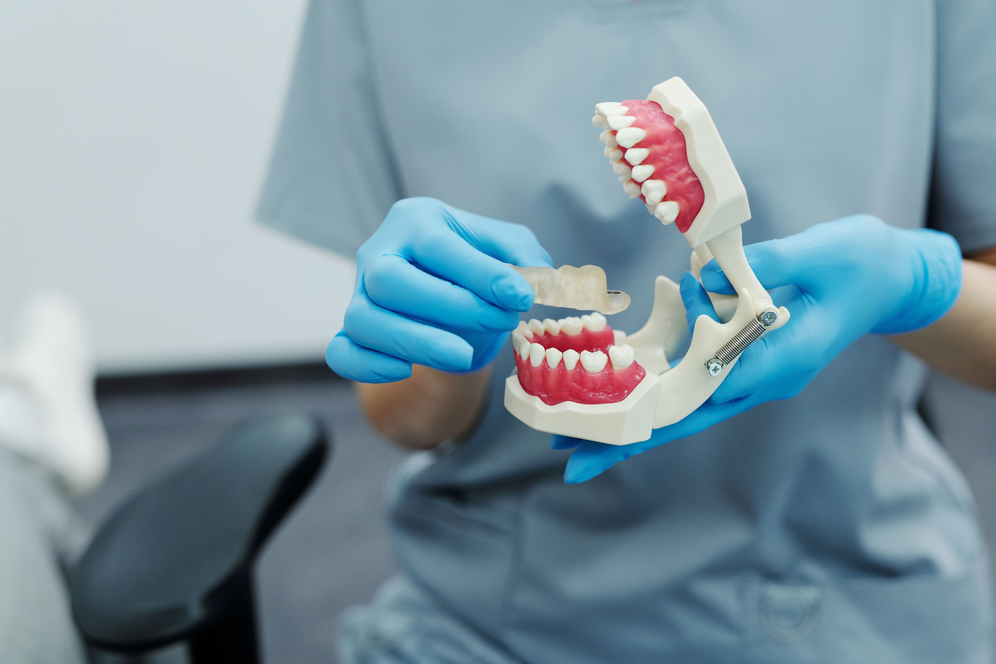 A dental model used to plan crown and bridge work